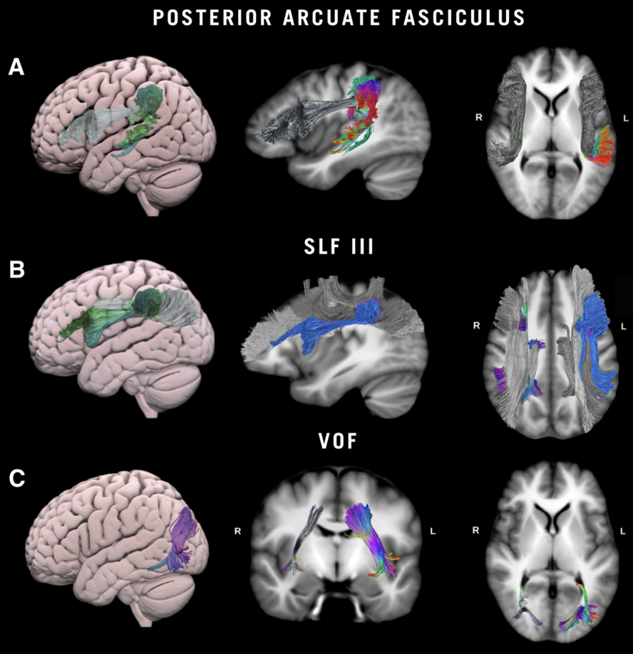 Figure White Matter Insight